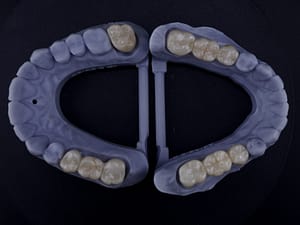 articulatie dentara corecta si ocluzie functionala model 3D