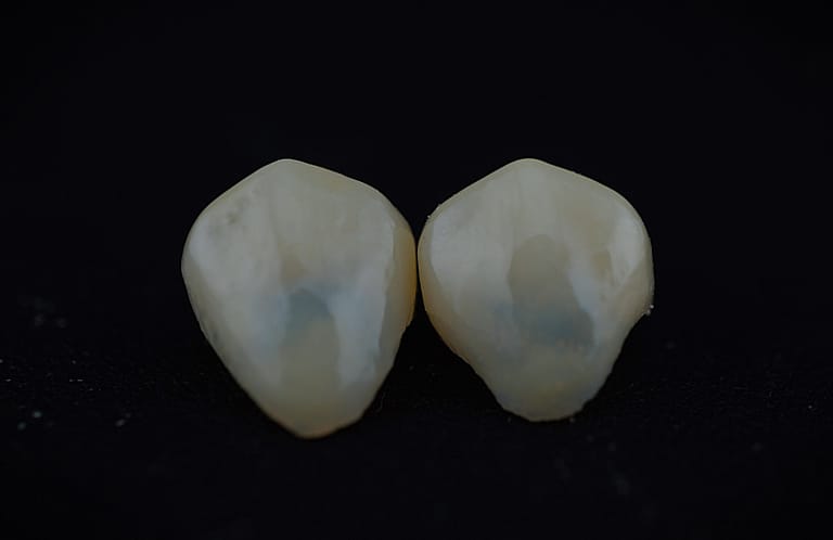 Fatete Emax